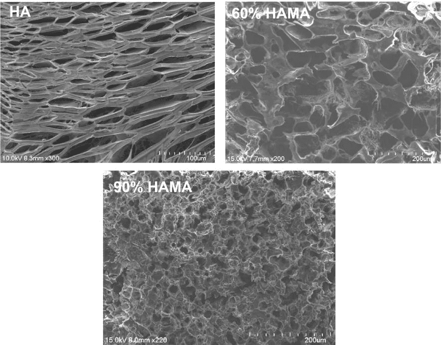 HAMA SEM micrograph